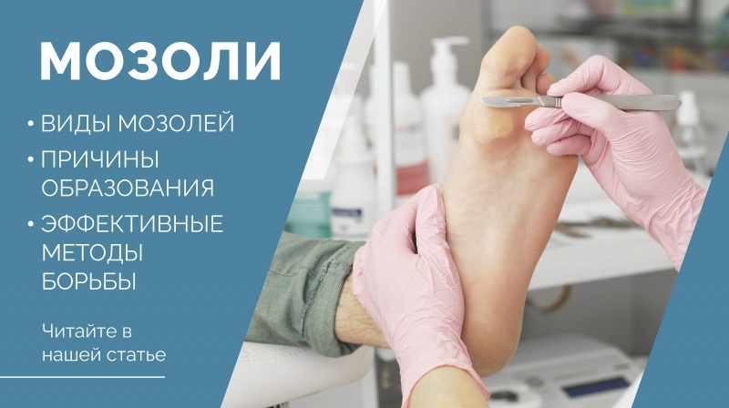 Причины образования мозолей и эффективные методы борьбы с ними. Причины образования мозолей и эффективные методы борьбы с ними.