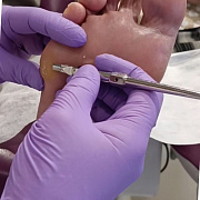 Скальпельные техники