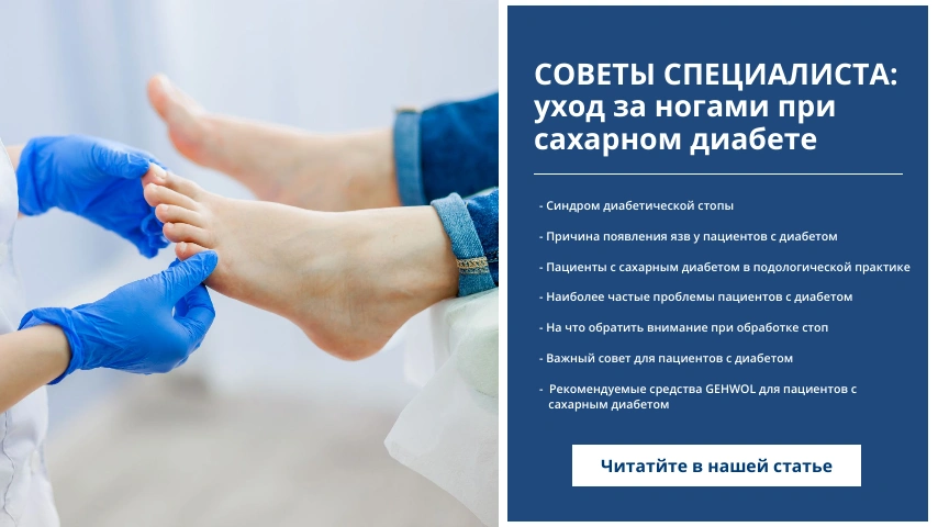 Советы от специалиста: уход за ногами при сахарном диабете<