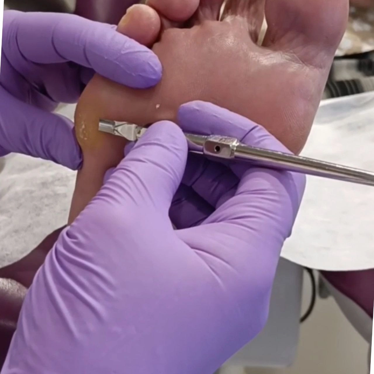 Скальпельные техники